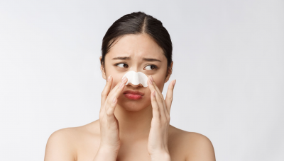 Ini Penyebab Tumbuhnya Jerawat di Hidung